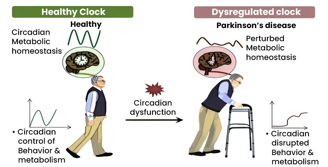 degenerative disorder in circadian disruption